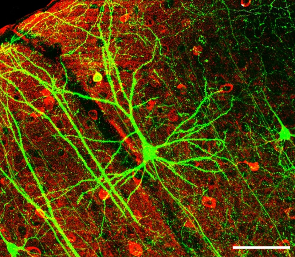 Neurón